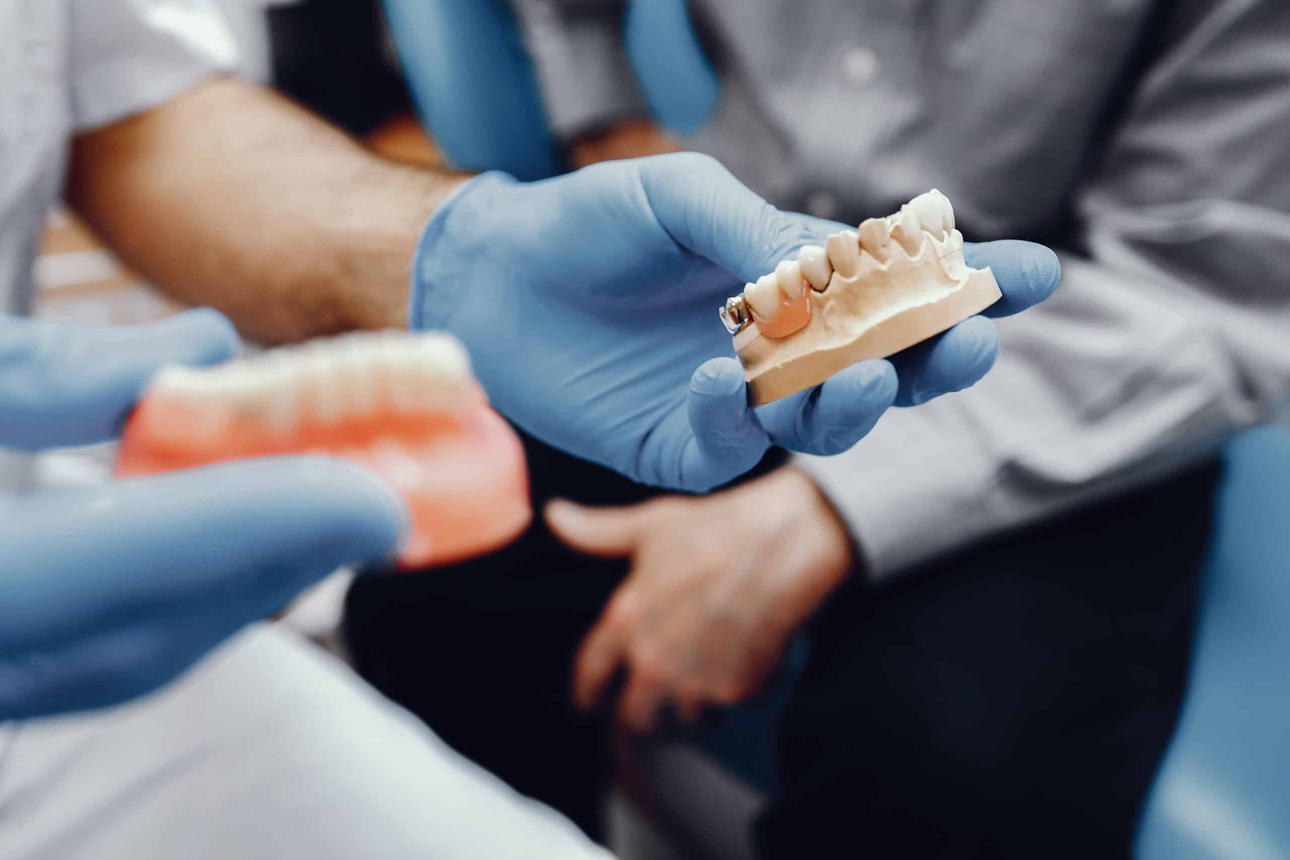 All-On-4 Implants: Choosing The Perfect Candidate